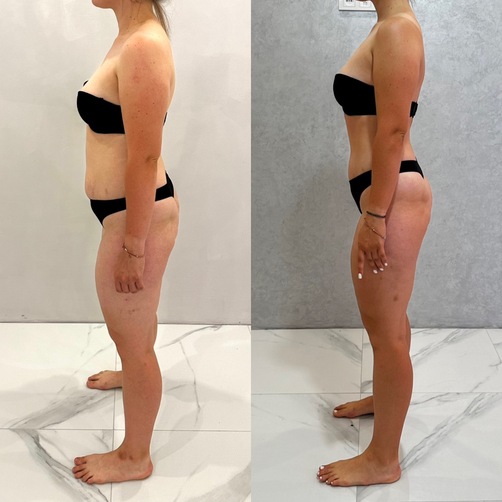 Результат 15